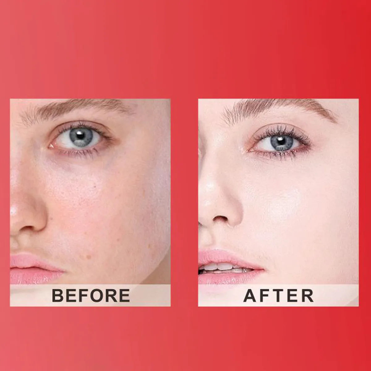 Crema Facial Kojic Acid