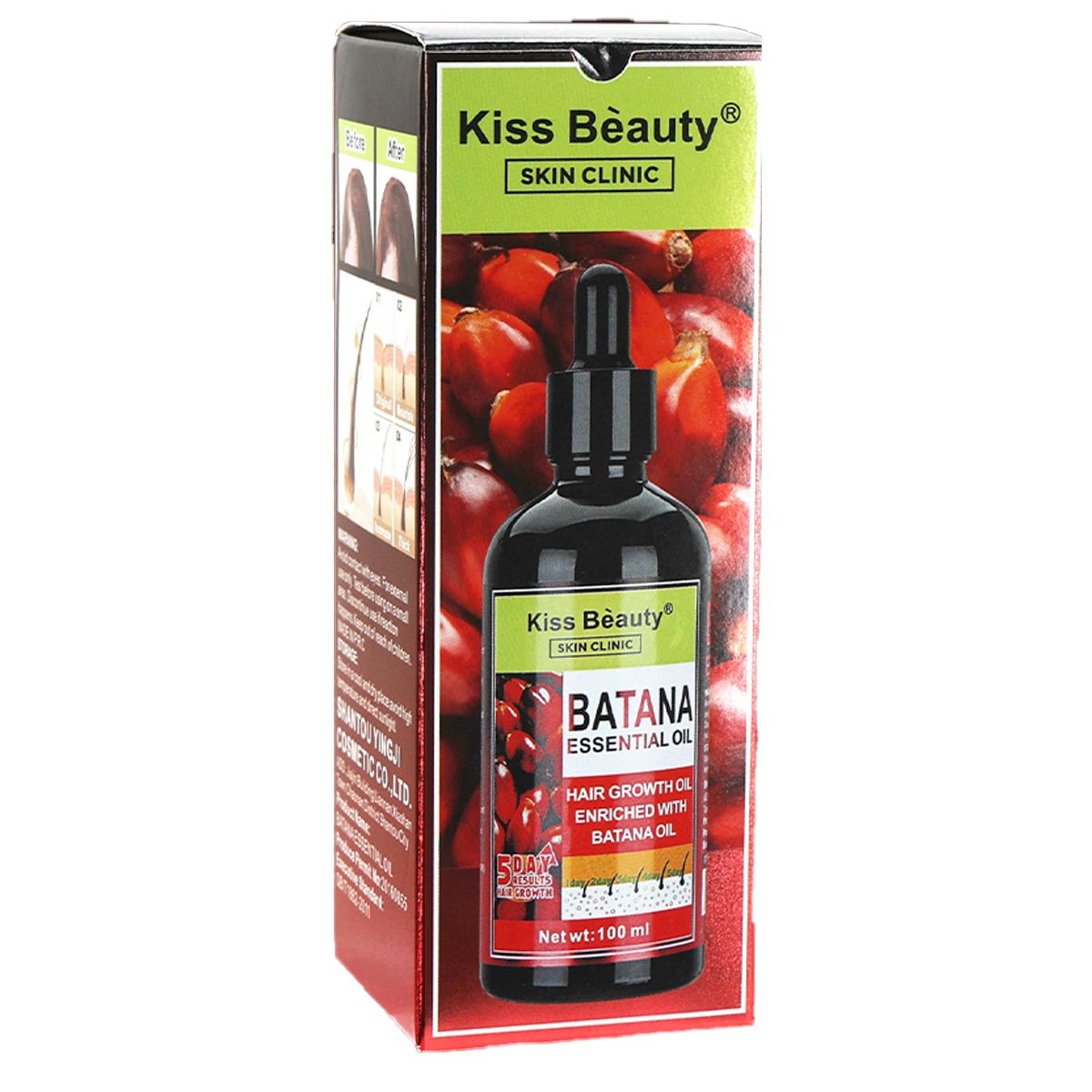Aceite Concentrado de Batana para Crecimiento y Anti Caída del Cabello.  Resultado en 5 Días.